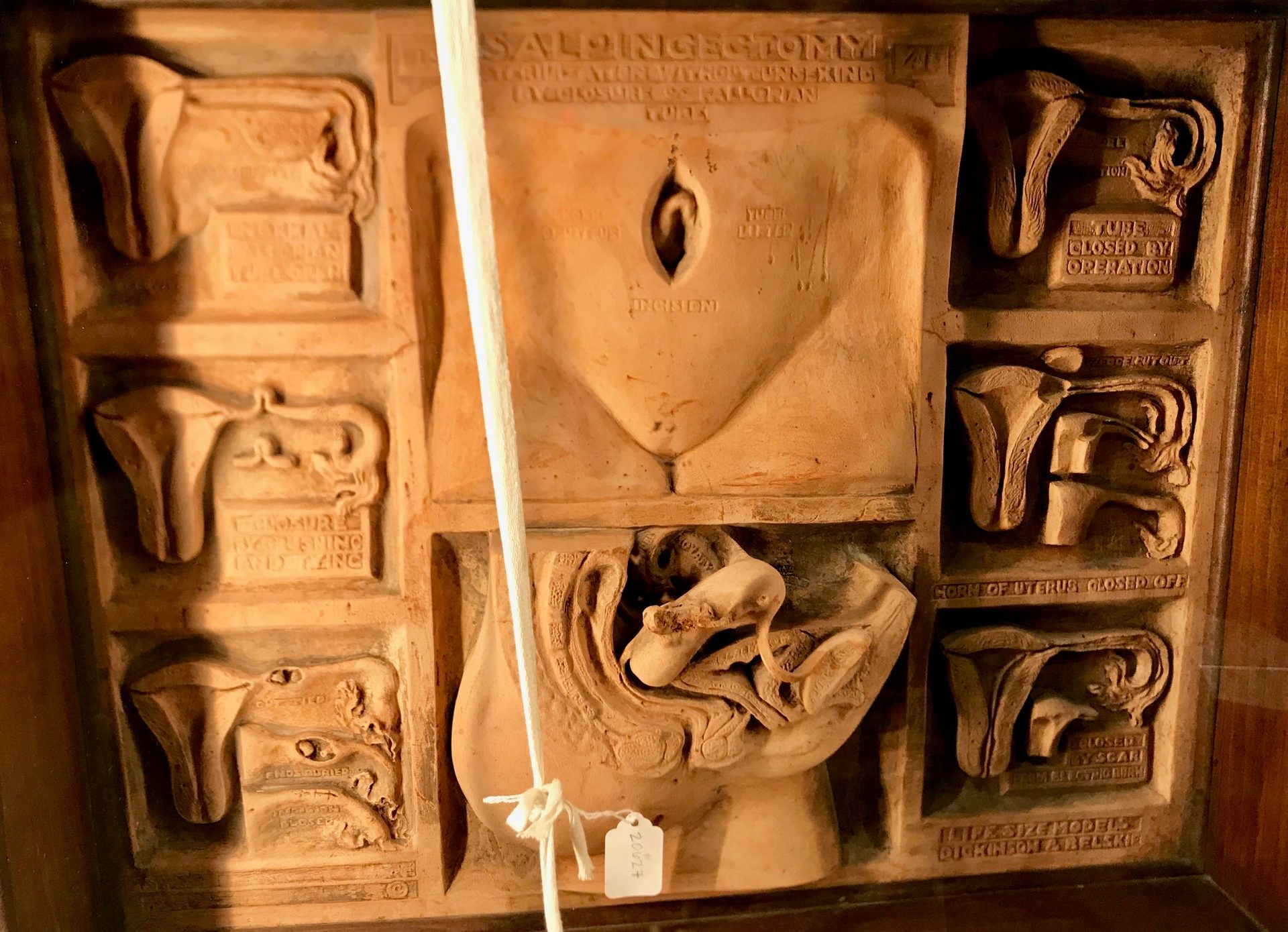 Dickinson-Belskie Collection, Warren Anatomical Museum, Boston (by Luca Ambrosio) (6).jpg